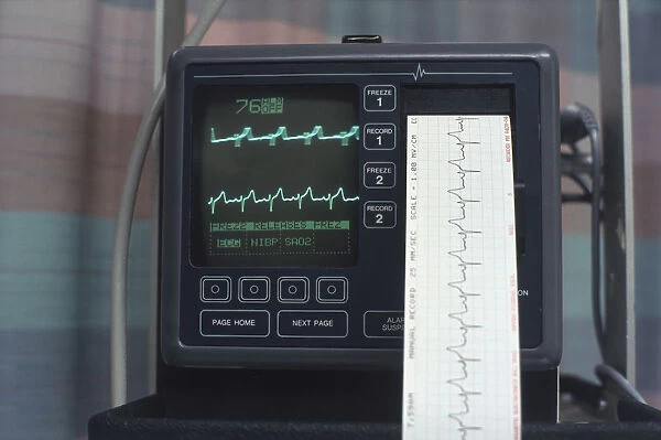 ECG monitor with printout coming out, close-up