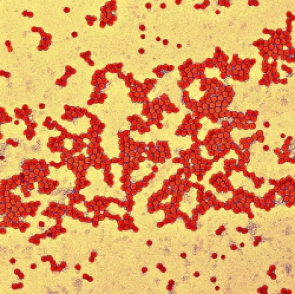 Buy Poliovirus particles, TEM