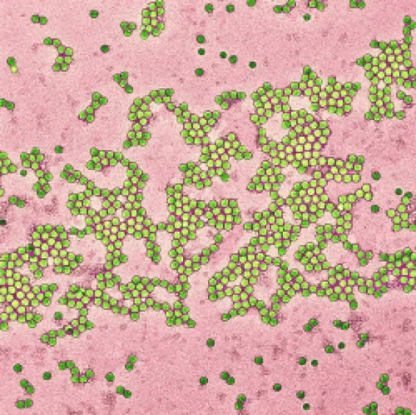 Buy Poliovirus particles, TEM