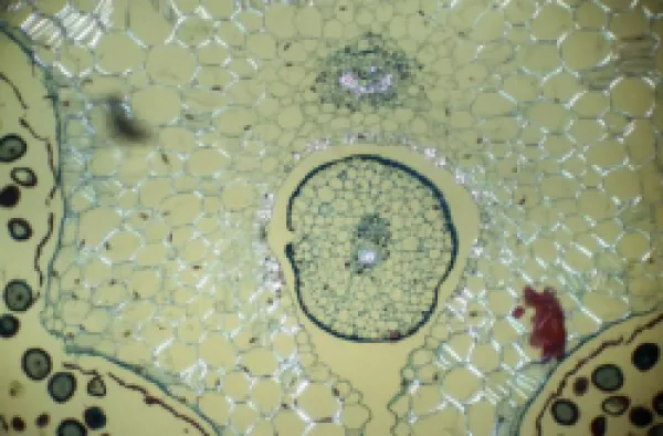 Buy Light Micrograph (LM): transverse section of Dehiscence Lilium Anther shows Filament and Vascular Bundles