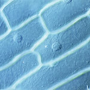 LM of cells in the epidermis of an onion
