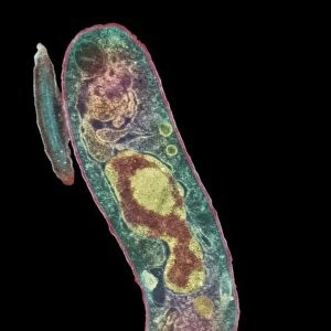 Parasitic protozoan, TEM