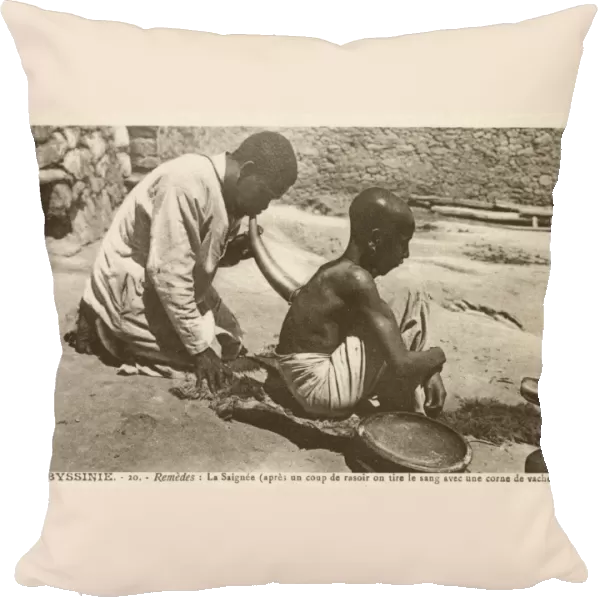 Ethiopia, Africa - Bloodletting