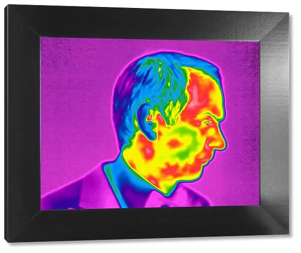 Mans face, thermogram