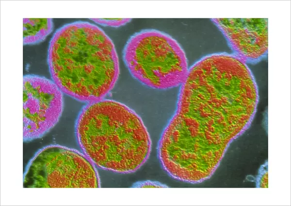 f  /  Colour TEM of Brucella abortus bacteria