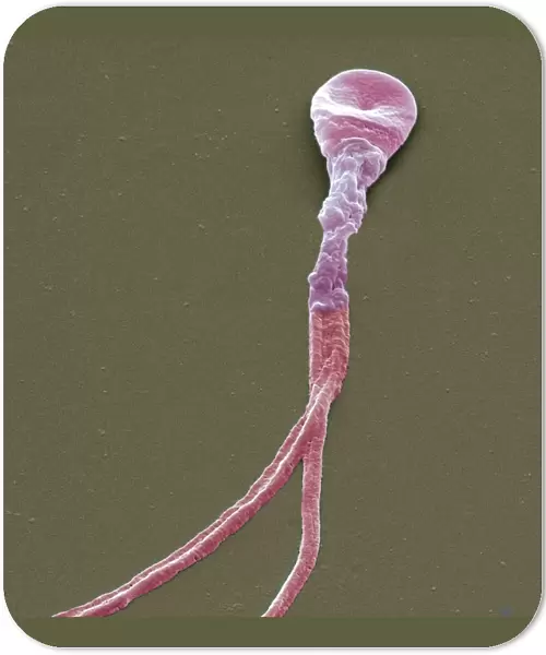 Deformed sperm cell, SEM