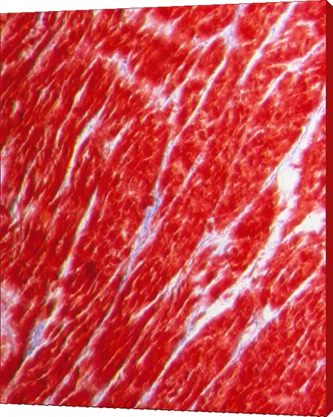 Light micrograph of normal heart (cardiac) muscle