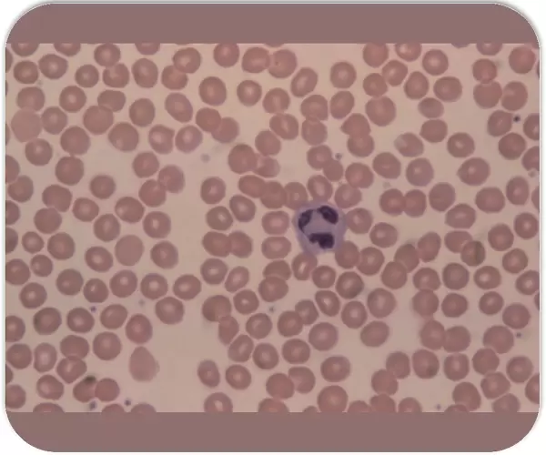 LM of human blood smear showing red & white cells