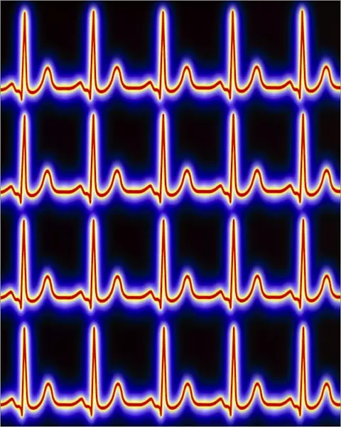 Artwork of healthy ECG traces of the heart