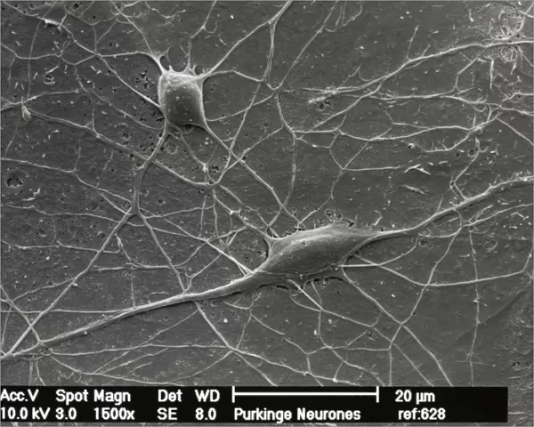 Purkinje nerve cells, SEM