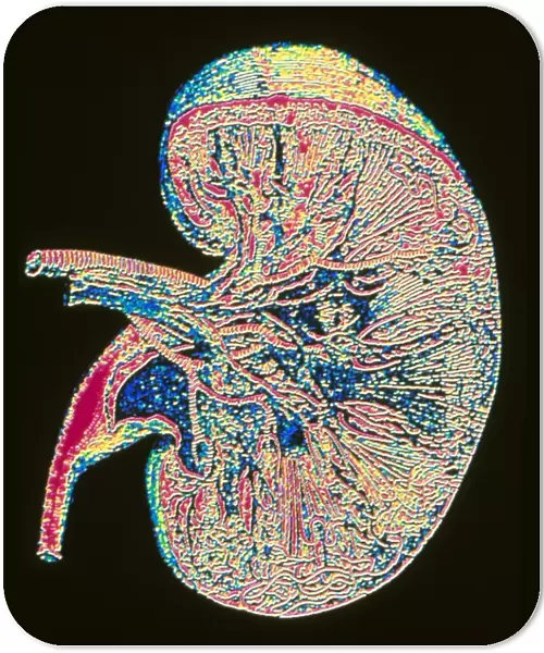 Computer graphic of section through human kidney