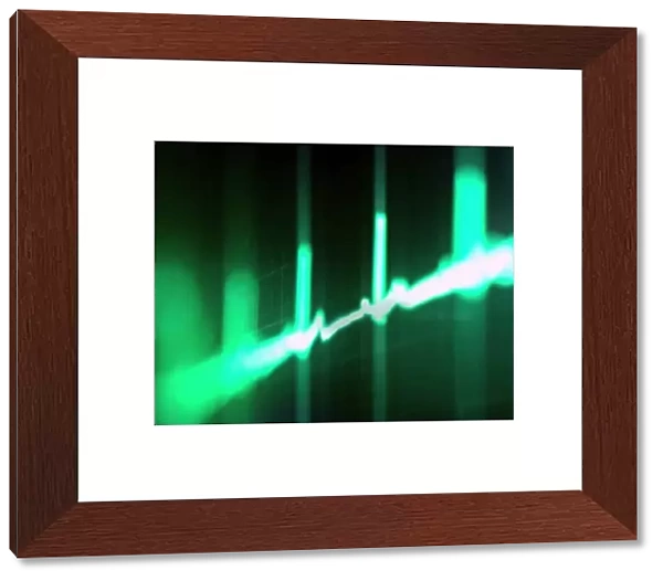 ECG. Computer artwork of an electrocardiogram (ECG) showing a normal heart rate