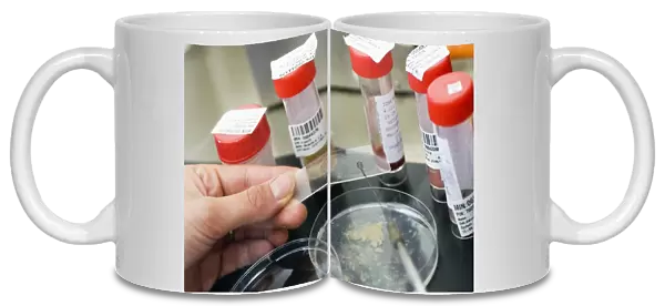 Testing sputum for lung diseases