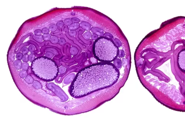 Nematode worm, transverse sections