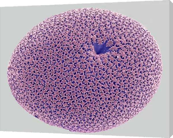 Orbulina foraminiferan, SEM