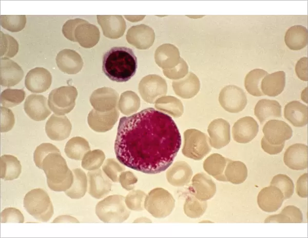 Myeloblast blood cell, light micrograph