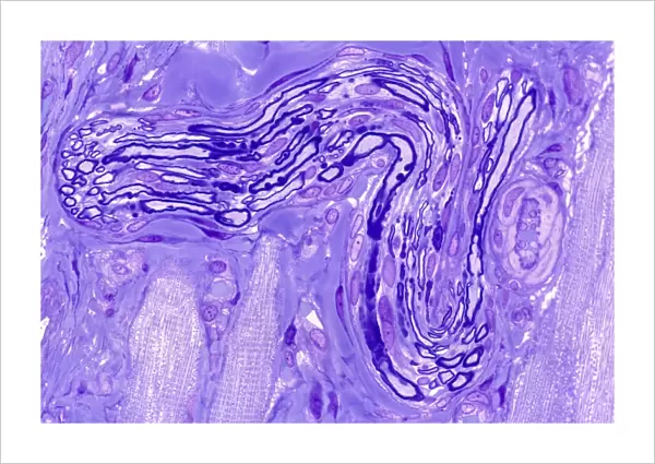 Myelinated nerve, light micrograph