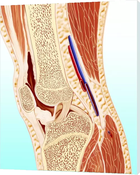 Human knee anatomy, artwork F008  /  1017