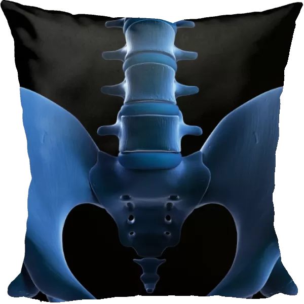 Painful lumbar spine, artwork