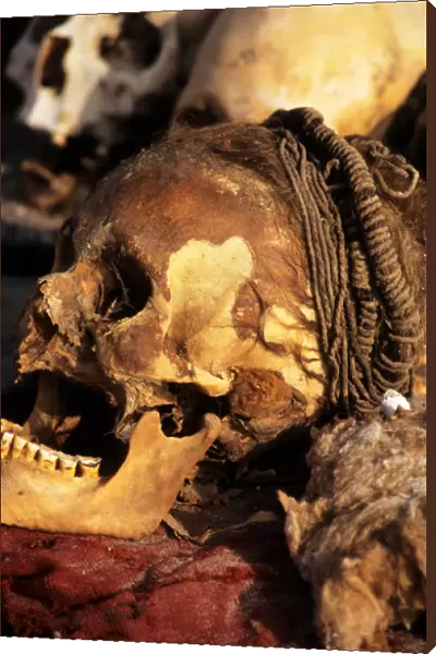 near Nasca, Peru. Skull with braided hair and skin, showing teeth badly worn down