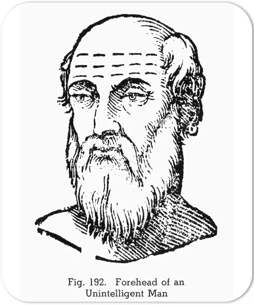 PHYSIOGNOMY, 1637. Forehead of an unintelligent man