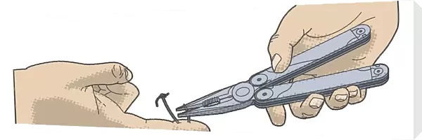 Digital illustration of cutting off barbed end of fish hook embedded in finger using pair of pliers