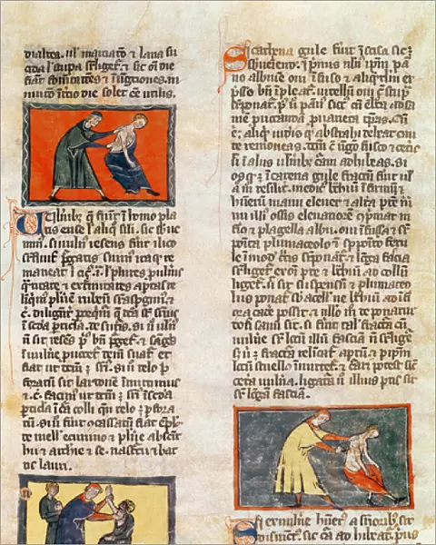 Ms H 89 fol. 17r Surgery, from an edition of the Book of Surgery by Rogier de Salerne