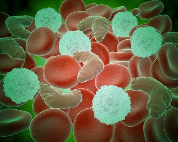 Sickle cell anemia with red blood cells and white bood cells
