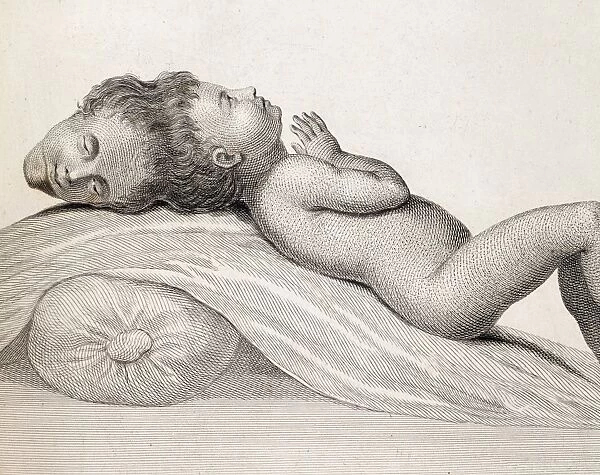 1787 Two Headed boy of Bengal by E. Home