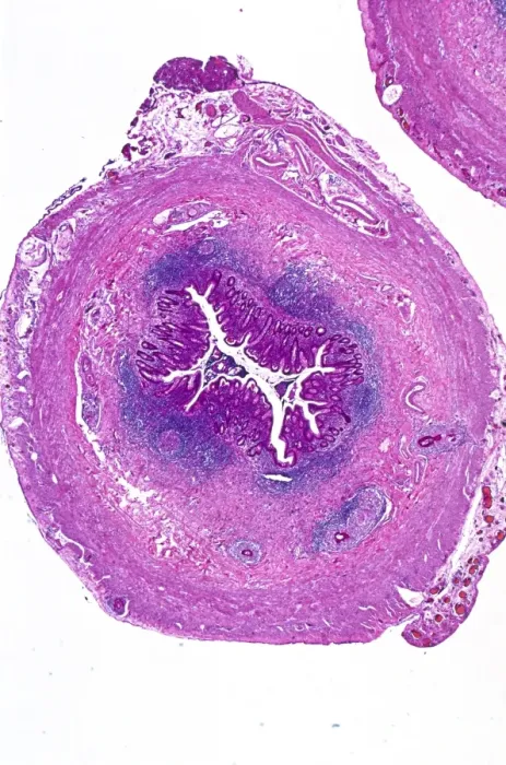 Framed Print : Appendix Light Micrograph Print Framed Print : Appendix Light Micrograph Print