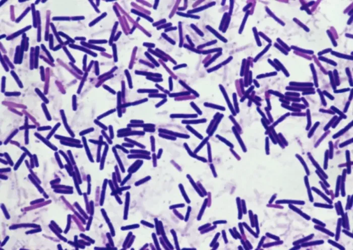 Framed Print : Botulism Bacteria Print - Light Micrograph of Clostridium botulinum
