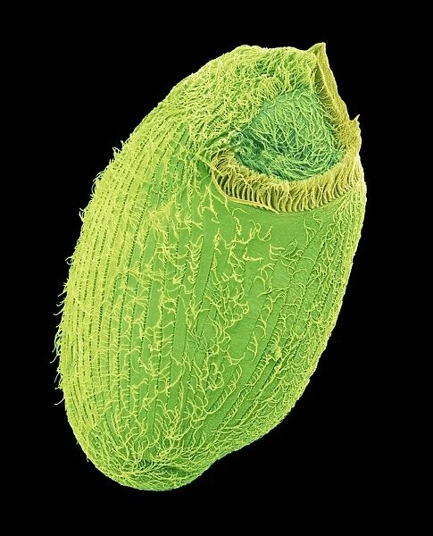 Climacostomum protozoan, SEM C016  /  9061