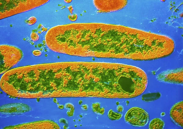 Coloured TEM of Yersinia pestis bacteria