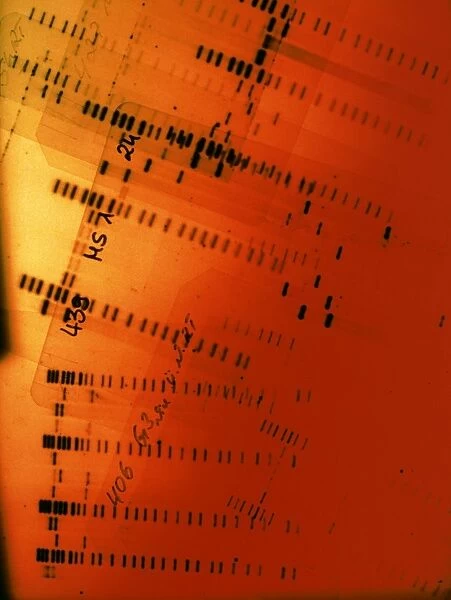 DNA fingerprint autoradiograms
