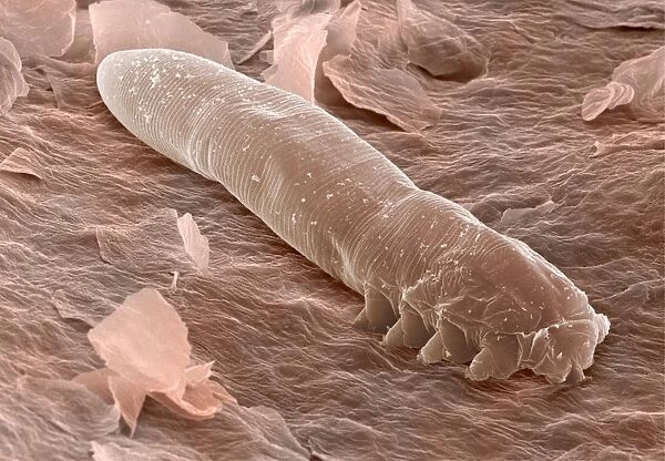 Eyelash mite, SEM. Eyelash mite. Coloured scanning electron micrograph 