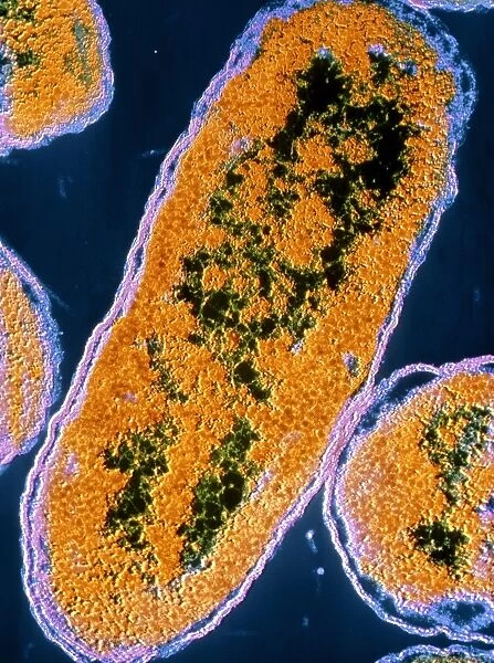 False-colour TEM of E. coli bacteria