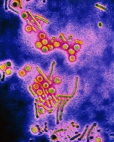 False-colour TEM of the Hepatitis B virus