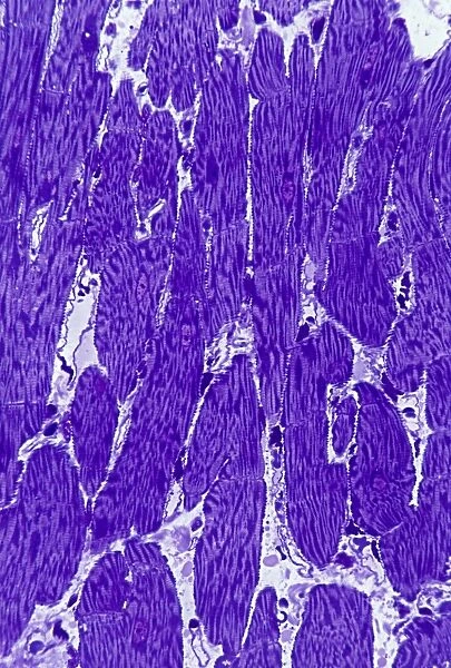 Heart muscle, light micrograph C016  /  0517