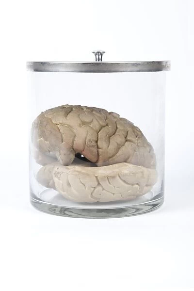 Human brain, historical anatomical model