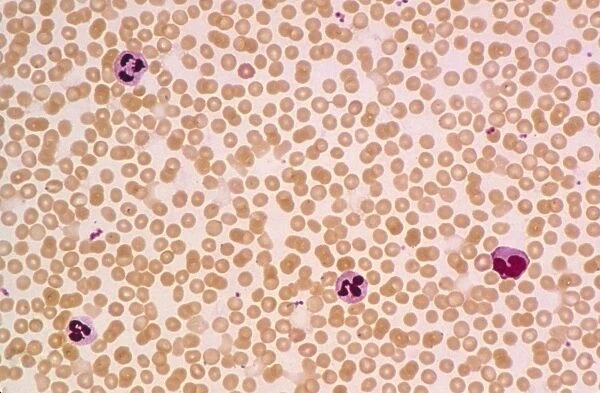 LM of a field of red and white blood cells