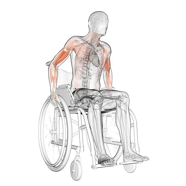 Man in a wheelchair, artwork F007  /  6383
