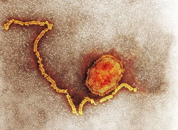 Measles virus particle, TEM C015  /  7163