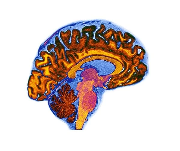 Normal human brain, MRI scan C016  /  8834