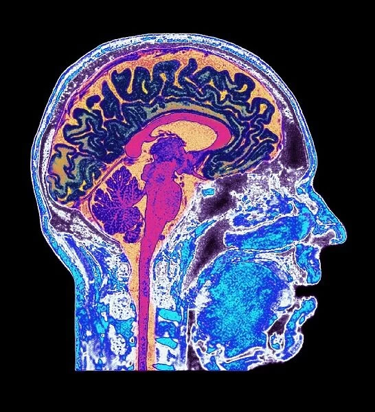 Normal human brain, MRI scan C016  /  8844