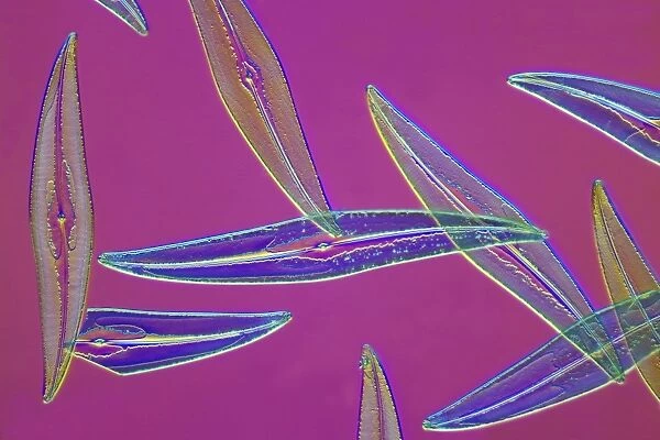 Pleurosigma sp diatoms, light micrograph