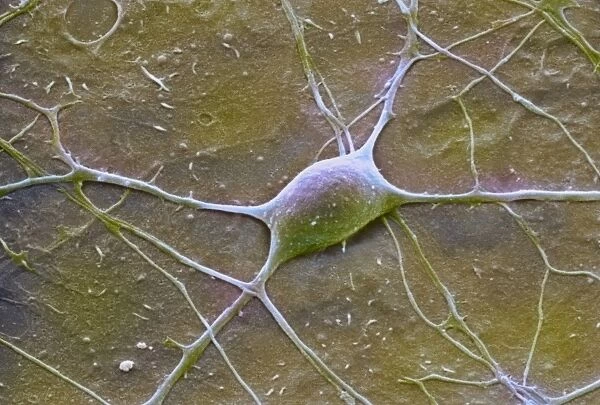 Purkinje nerve cell, SEM