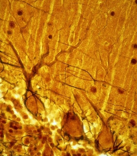 Purkinje nerve cells C013  /  9745