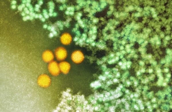 Schmallenberg virus particles, TEM