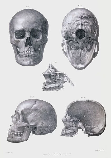Skull Crown Occult Anatomy Wall Art Print Number 358 A4  Historic Picture 