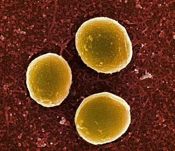 Staphylococcus aureus bacteria, SEM C013  /  4769